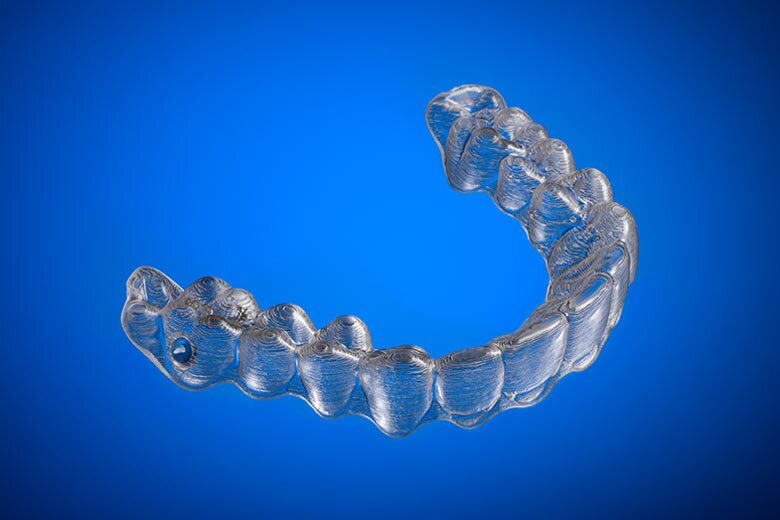 invisalign clear trays west village dental clinic toronto