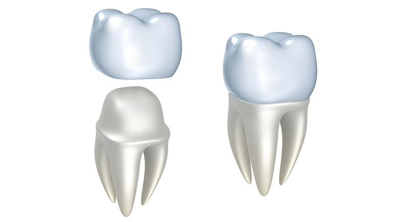 Learn When Dental Crowns Are Used For Children