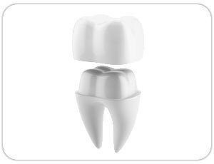 dental crown or dental cap - toronto dentist - west village dental