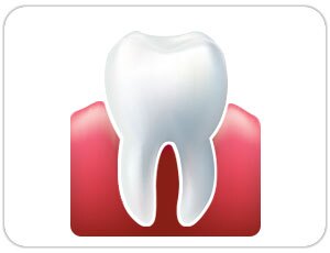 wisdom tooth extraction - toronto dentist - west village dental
