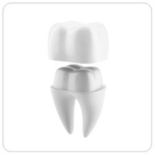 cerec-dental-crown-west-village-dental-toronto